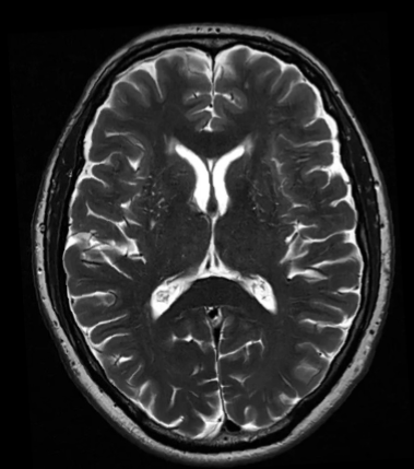 <p>Type of scan, orientation </p>