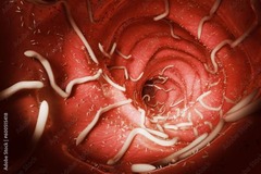 <p>Protozoa (e.g., malaria, toxoplasmosis) and helminths (e.g., flatworms, roundworms).</p>