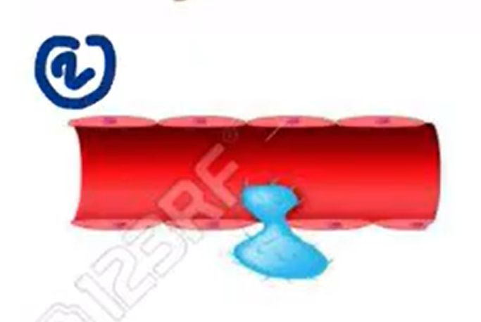 <p><strong>H1 receptors</strong> are also found in <strong><em>(1) <u>cells</u>,</em></strong> specifically in the <strong><em>(2) lining of __________.</em></strong></p>