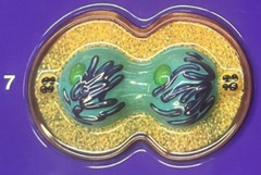 <p>Telophase</p>
