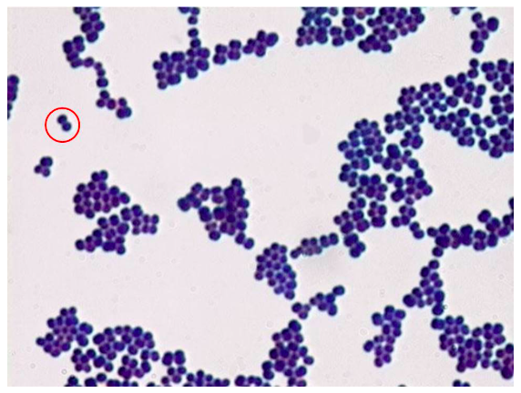 <p><span>What is the shape and arrangement of the circled bacterial cells?</span></p>