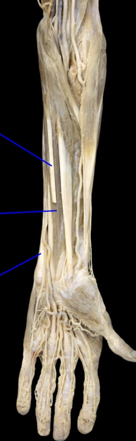 <p>what is the 2nd tagged (from left to right) area? Then state the origin, insertion, and main actions.</p>