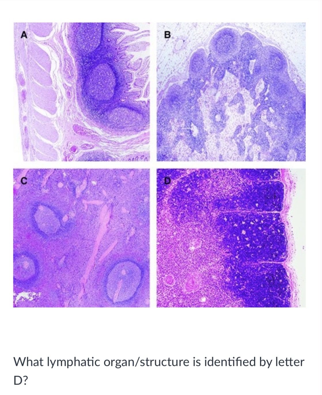 <p><span>Lymph node</span></p><p><span>Thymus</span></p><p><span>Peyer's patches</span></p><p><span>Spleen</span></p>