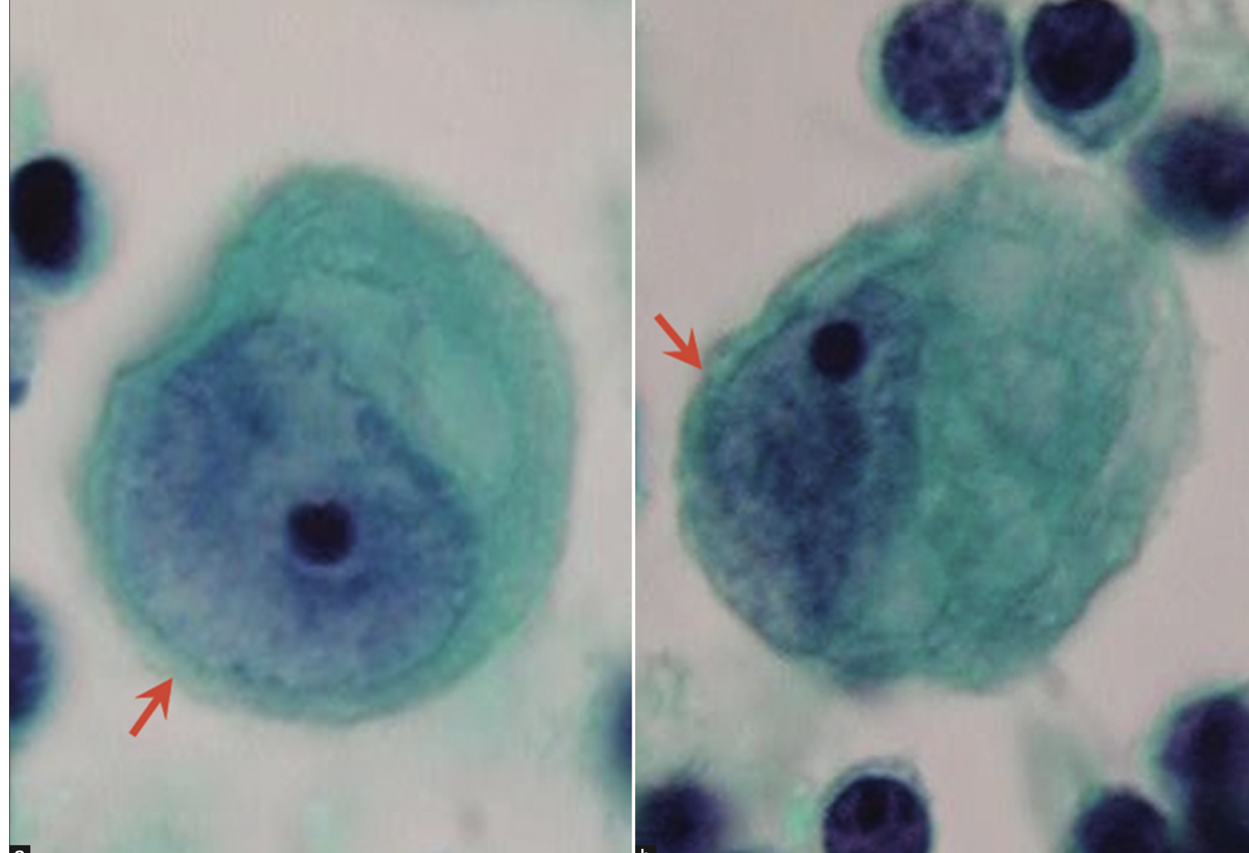 <p>Morphologie typique des cellules mésothéliales</p>