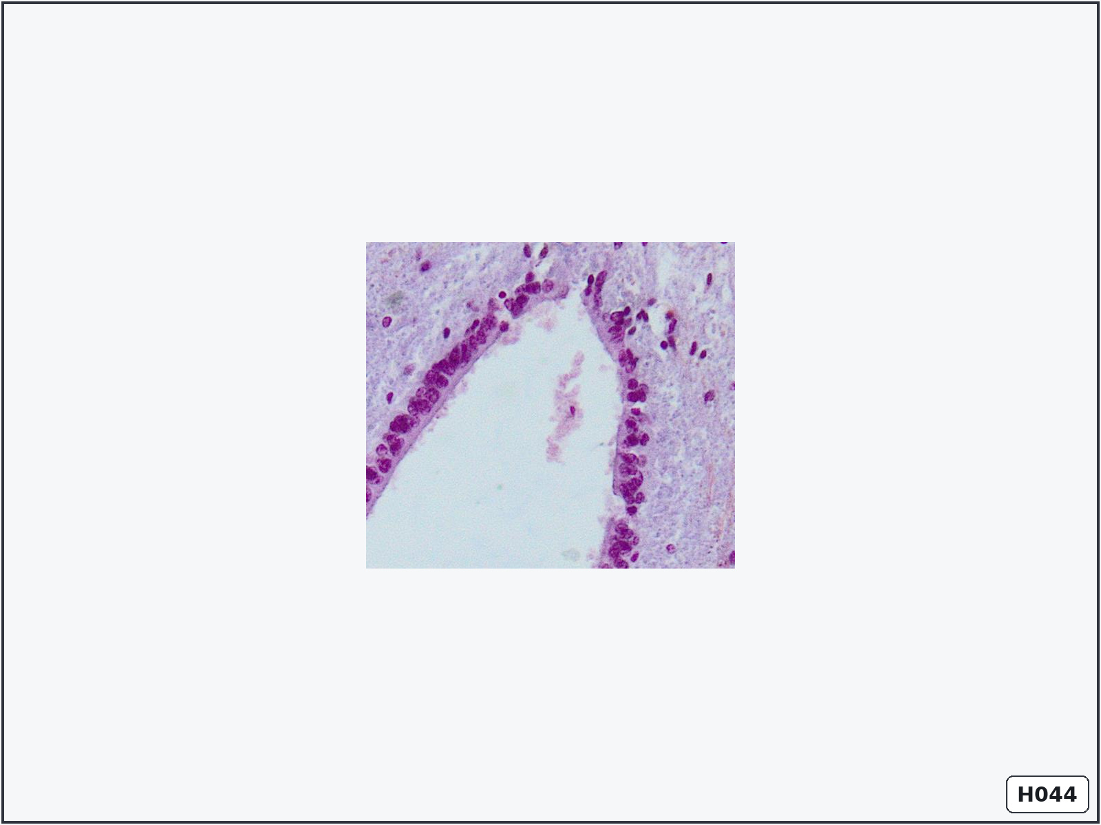 term image