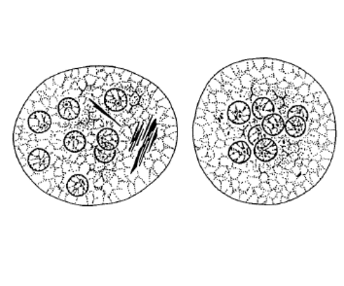 <p>Trophozoite has large eccentric karyosome with clumped chromatin along the membrane</p><p>Cyst has 8 nuclei, frayed end chromatin bars </p><p>NONPATHOGENIC</p>