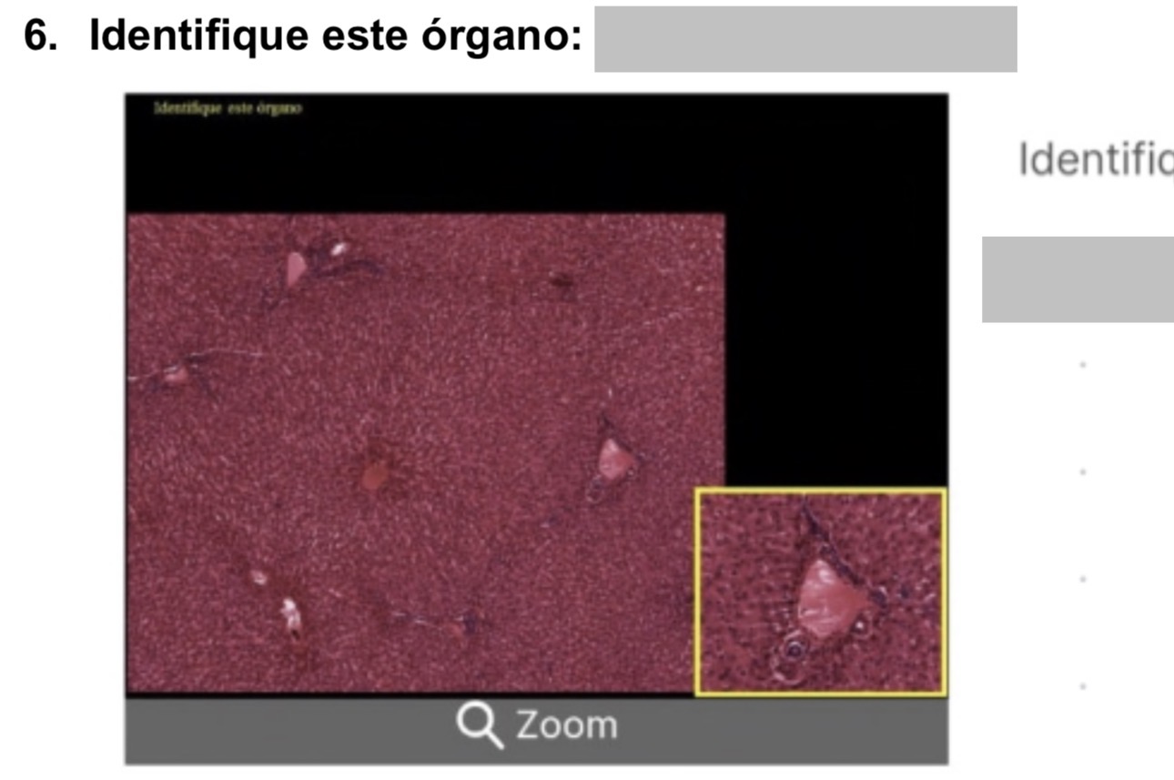 <p>hígado </p>