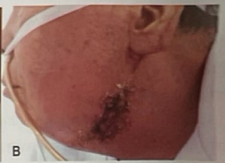 <p>CHẨN ĐOÁN?</p>