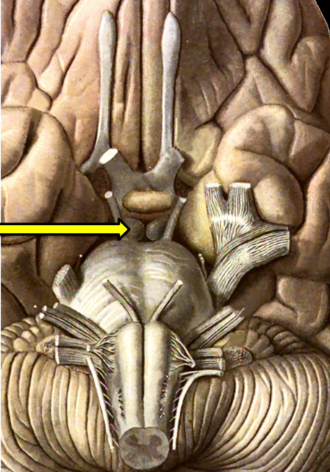 <p>What structure is indicated by the arrow?</p><p>A mammillary body</p><p>The optic tract</p><p>The head of the caudate nucleus</p><p>The body of the caudate nucleus</p><p>A part of the thalamus</p>