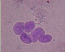 <ul><li><p>bladders, ureters, renal pelvis, and proximal urethra </p></li><li><p>round but occasionally pear shaped, smaller than squamous </p></li><li><p>small granular nucleus</p></li></ul><p></p>