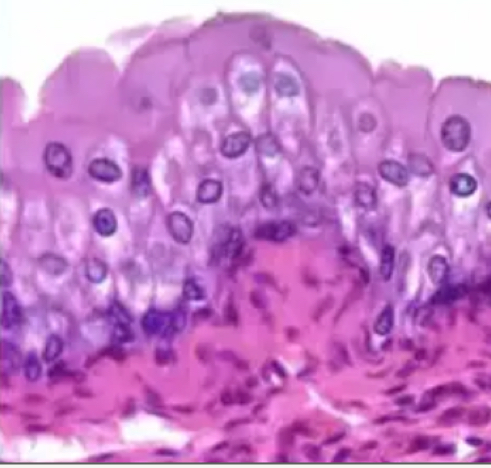 <p>Function of <strong>transitional epithelial tissue</strong></p>