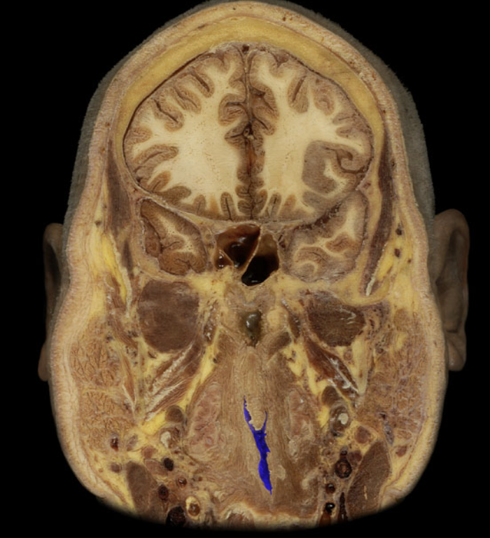 term image