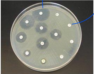 <p>susceptibility; most; dropping; width</p>