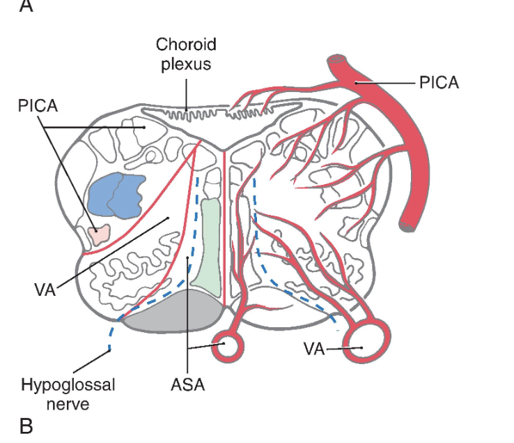 <p> Identify each of the vascular territories in the illustrations.</p><p> Identify the motor and sensory nuclei found within the territories served by each vessel.</p><p> Identify the motor and sensory tracts, or fiber bundles, found within the territories served by</p><p>each vessel. Describe the location of the cells of origin and the site(s) of termination for these</p><p>tracts/fibers. Be sure to specify laterality.</p><p> Determine what motor and sensory deficits (if any) would result from occlusion of the vessels</p><p>supplying the medulla oblongata. See text for help</p>