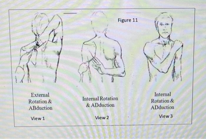 <p>quick check of AROM</p><p>1) horizontal adduction with internal rotation (behind the back)</p><p>2) abduction with external rotation (overhead)</p><p>3) adduction with internal rotation (across chest)</p><p>for frozen shoulder (?)</p>