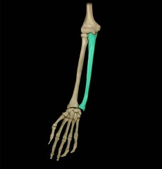 <p>Medially bone of forearm, aligns with 5th digit</p>