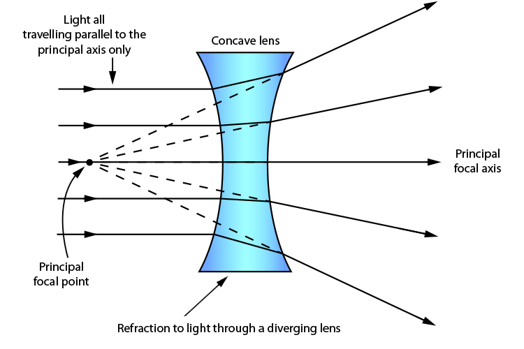 <p>concave</p><p>far objects blurry</p><p>rays cross in front of retina (need to move onto retina so behind where it is now)</p><p>power should be negative (for concave lens)</p>