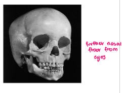 <p>age 4 skull </p>
