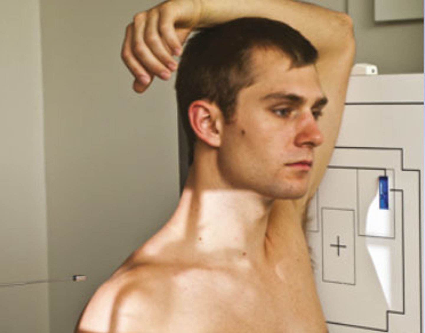 <p>S - around waist</p><p>T - 120 mAs @ 80 kVp</p><p>A - none</p><p>M - L marker in front of PT</p><p>P - L side to bucky w/ arm closest above head, CR 1" above jug notch</p><p>S - 72"</p><p>B - expiration</p><p>C - 14 x 17 lengthwise</p>