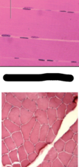 <p>tvärstimmig</p><p>perifera kärnor</p>