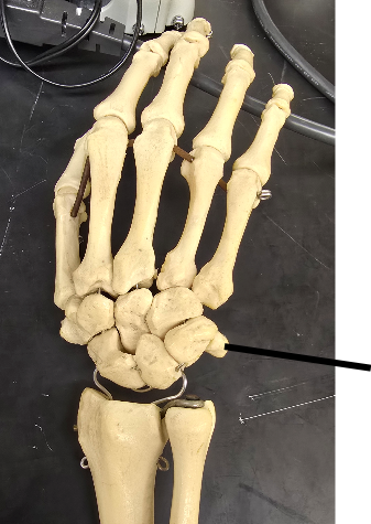 <p>Name Carpal Bone</p>