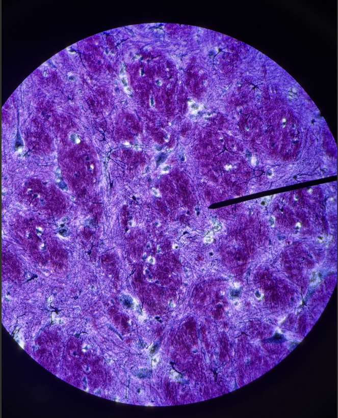 term image