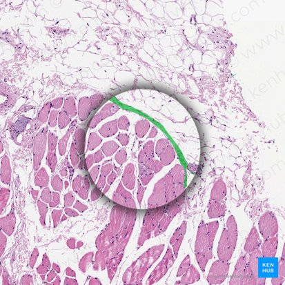 <p>Surrounds whole muscle, fascia, continuous with tendons, dense irregular connective tissue</p>
