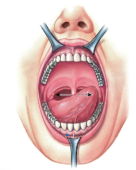 knowt flashcard image