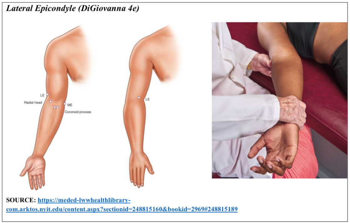 <p>E Sup Abd</p><p>Point is lateral epicondyle of humerus</p><p></p><ol><li><p>pt supine, physician on same side of point</p></li><li><p>pt elbow fully extended. Use table as fulcrum to put arm into position</p></li><li><p>arm supinated and abducted with varying amounts of force</p></li></ol><p></p>