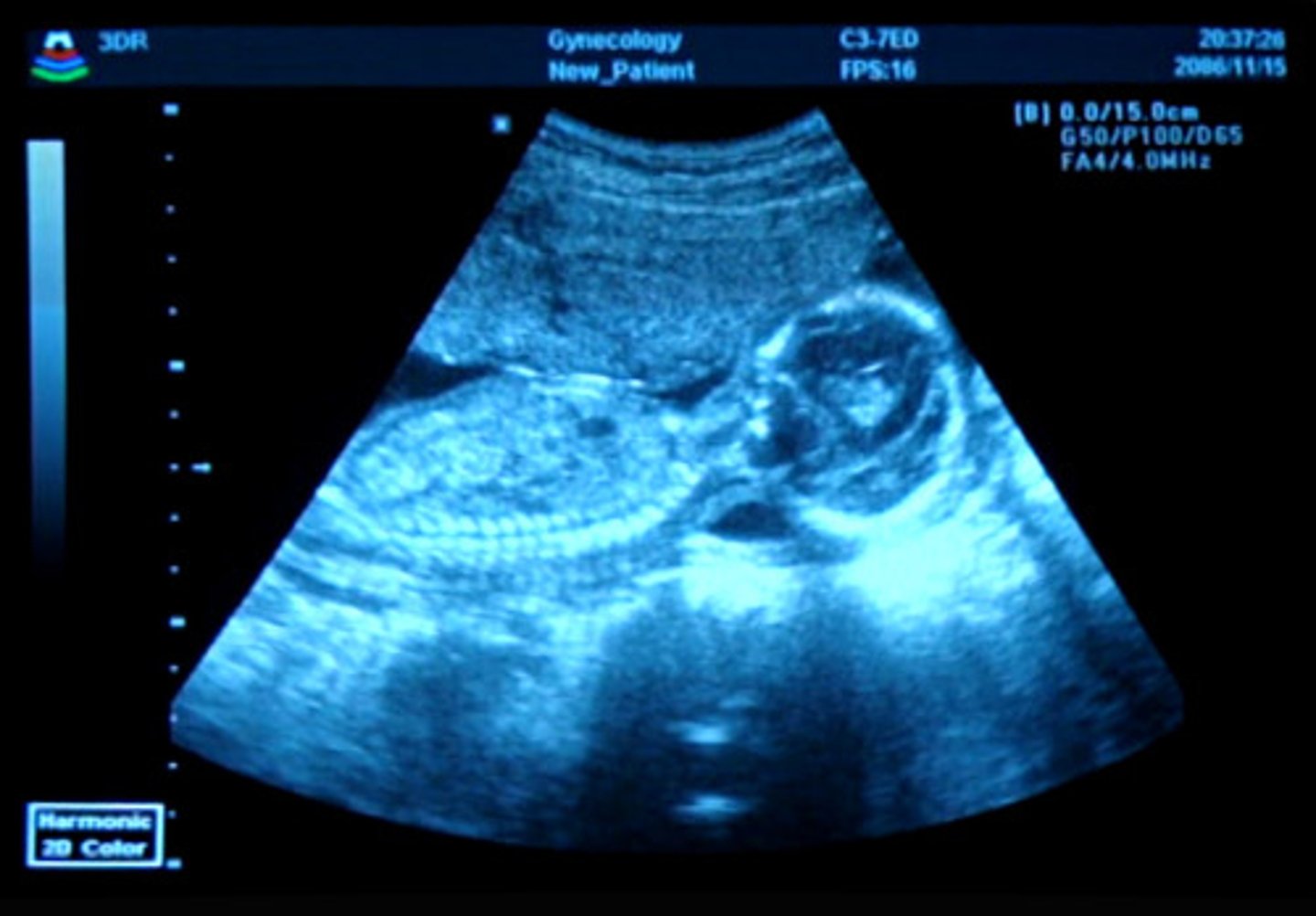 <p>Uses ultrasound waves to create images.</p>