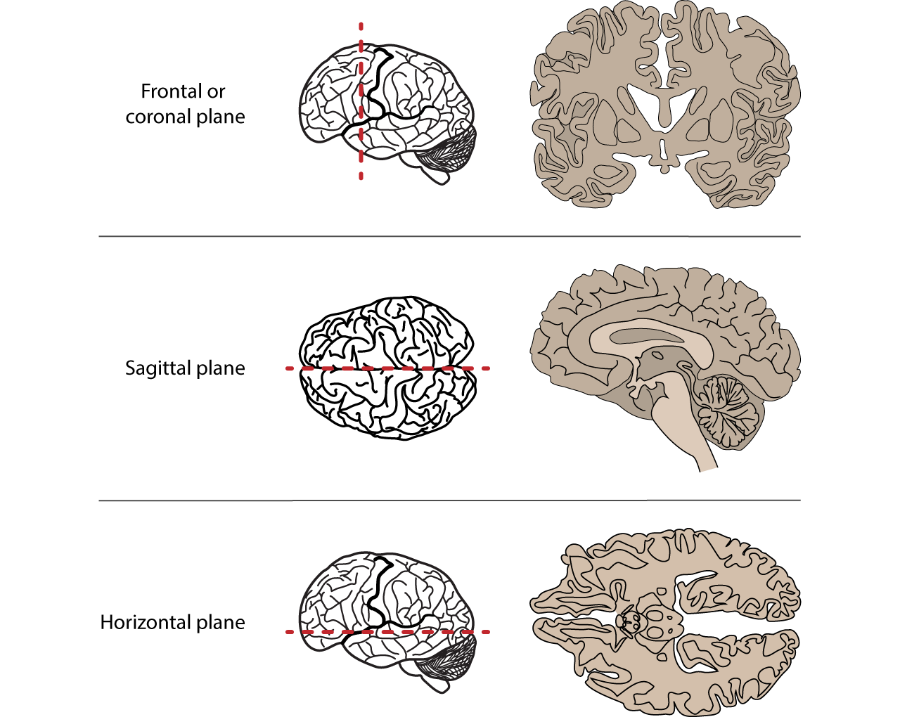 <p>divides the brain into anterior and posterior sides</p>