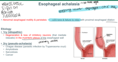 <p>esophogeal achalasia</p>