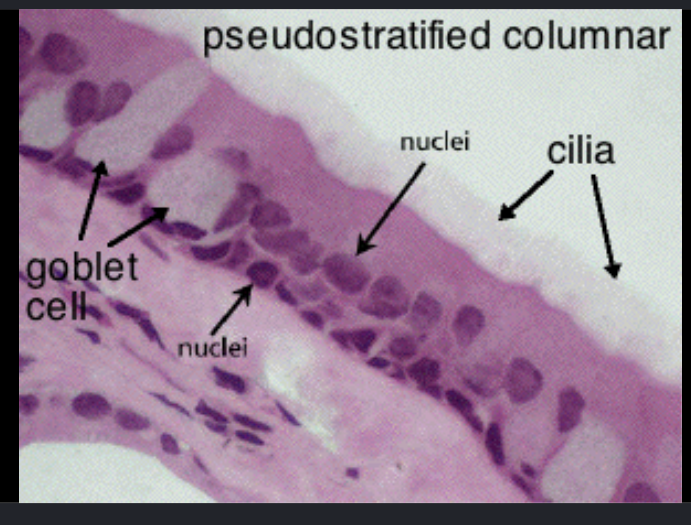 <p>top white layer → cilia</p><p>clear/white circles → goblet cell </p>