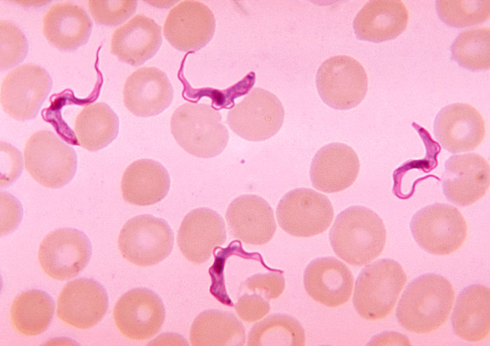 <p>The organism pictured is found in the blood and causes</p>
