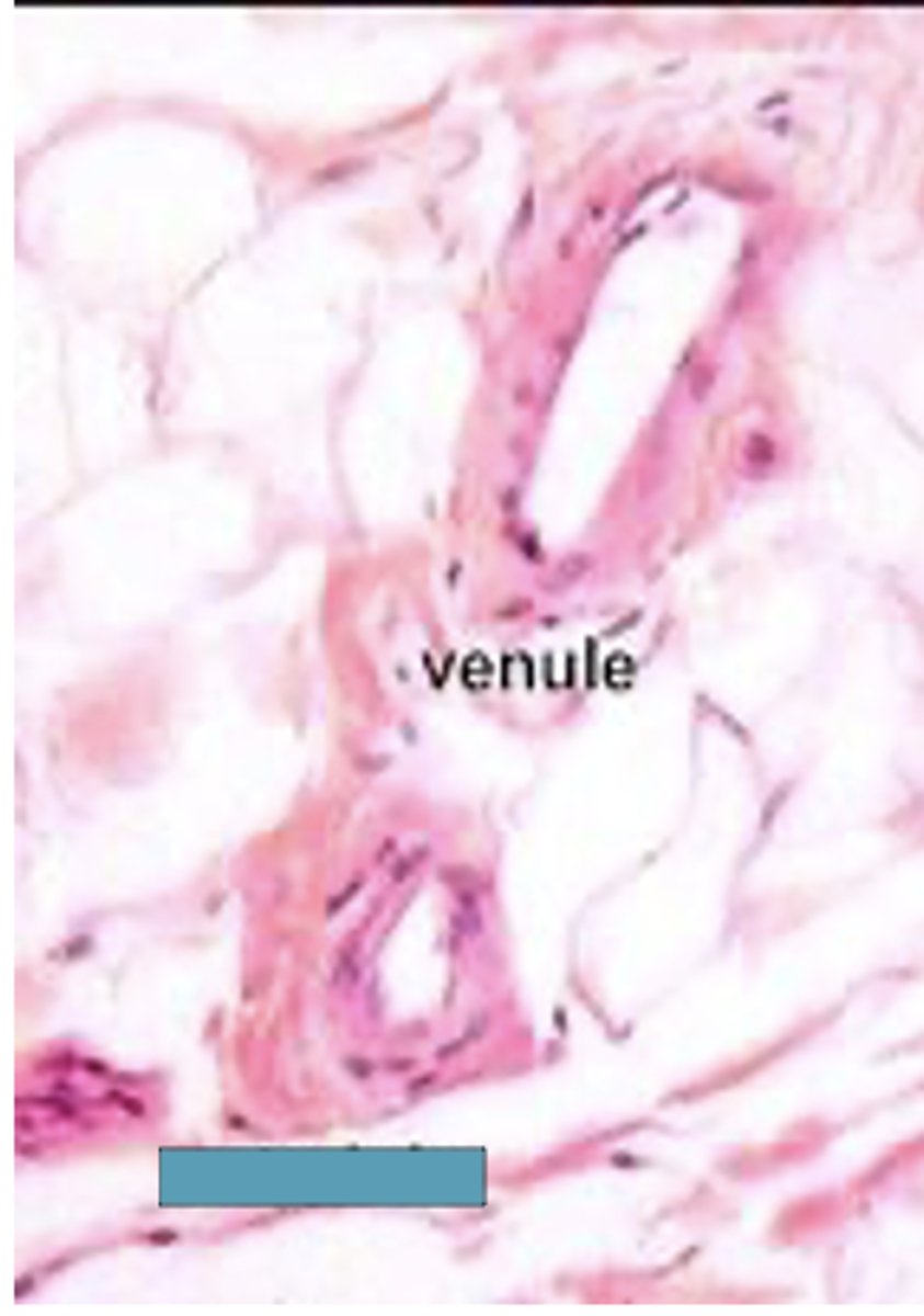 <p>Classify the vessel</p>