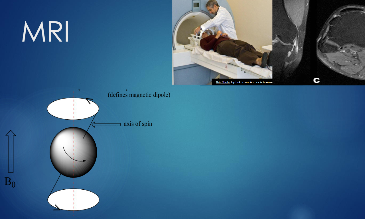 <p>it uses the magnetic resonance properties of protons </p><ul><li><p>nucleus of hydrogen atom (which are abundant in biological tissues) </p></li></ul><p>produces 3D detailed images </p><p></p>