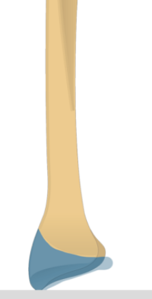 <p>What is this pointing to? What bone is it on?</p>