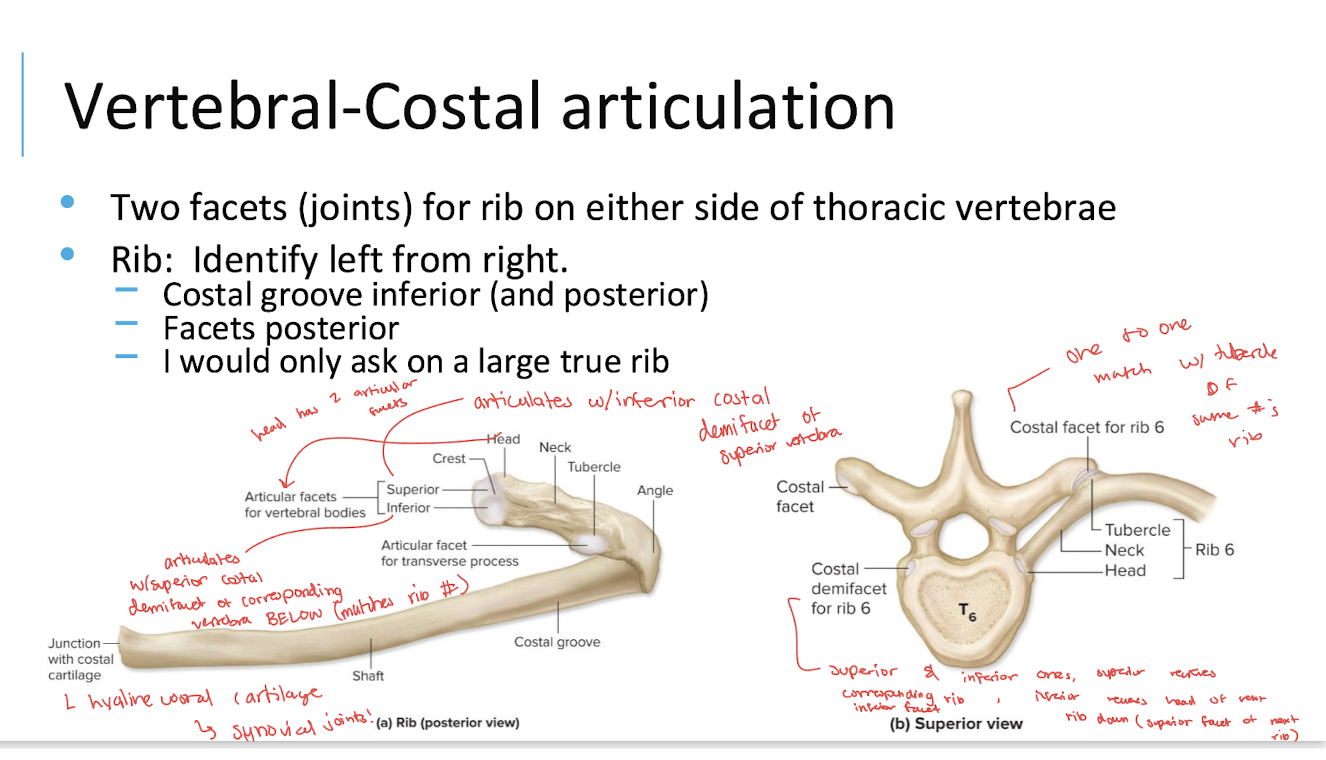 <p>Synovial joints</p><ul><li><p>Fibrocartilage</p></li></ul><p></p>