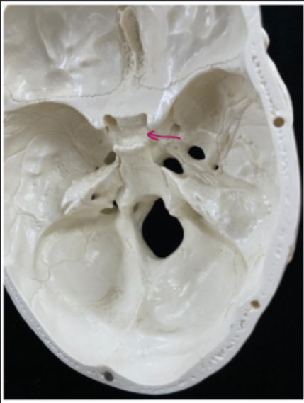 <p>What bone is this?</p>