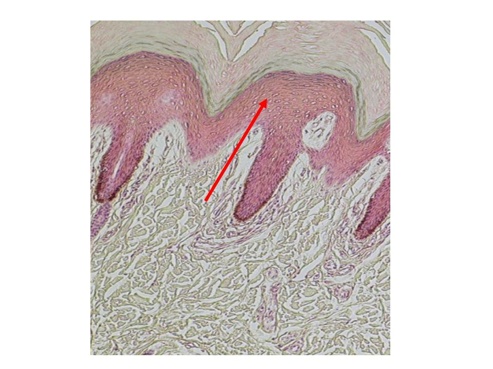 term image