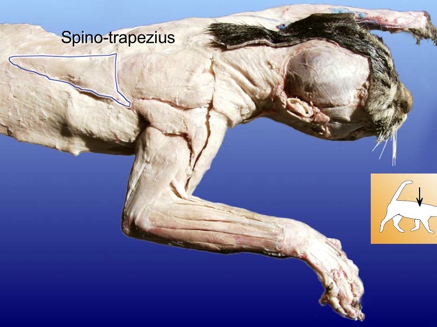 <p>spino-trapezius</p><p>action: depresses scapula</p><p>s: pectoralis minor</p><p>a: levator scapulae</p>