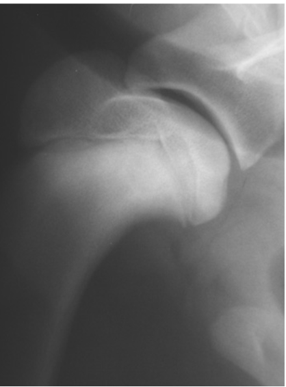 term image