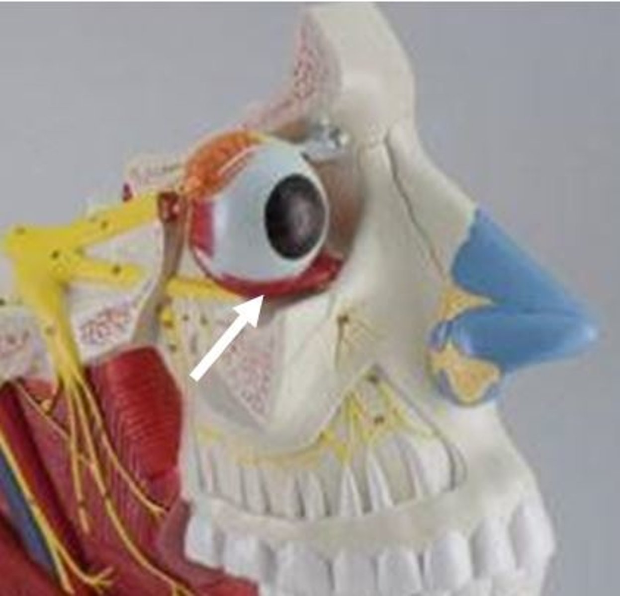 <p>Identify this muscle.</p>
