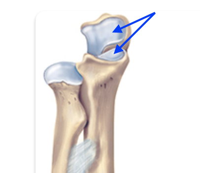 <p>Identify the anatomical feature of the ulna.</p>