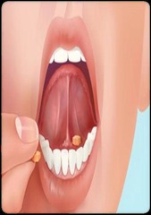 <p>A method where a tablet or pellet is placed under the tongue or crushed in the mouth for rapid absorption.</p>