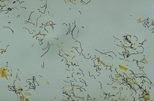 <p><em>University of Utah WebPath. (n.d.). Spirochetes with Warthin–Starry silver stain [Photomicrograph].</em></p>