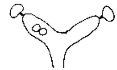 <p>Describe this fixation. What issues does it cause?</p>