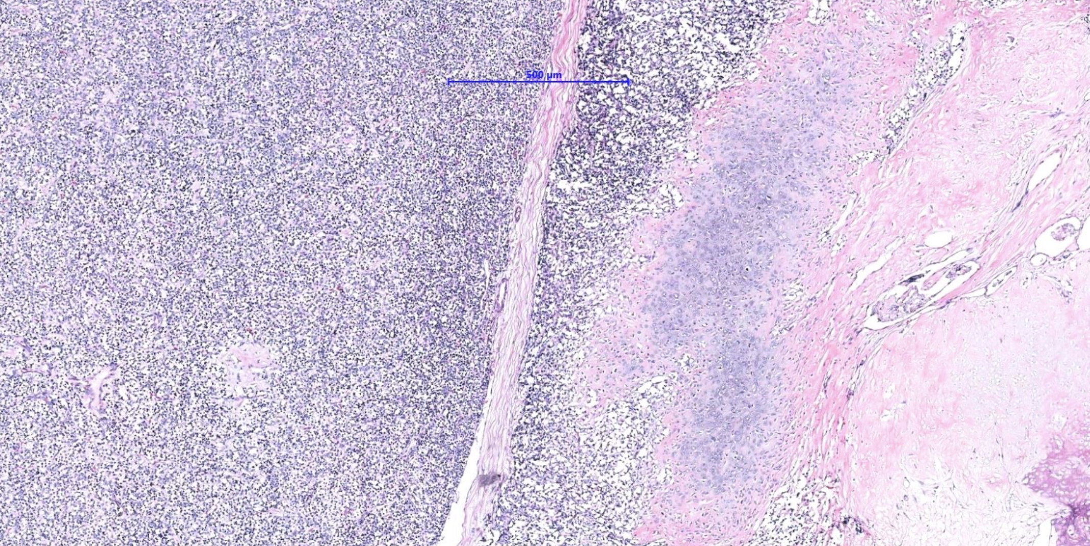 <p>Tumeur de la base du crane jeune homme</p><p>diagnostic</p><p>définition</p><p>age</p><p>topographie</p><p>anatomie</p><p>histologie</p><p>IHC moléculaire</p>
