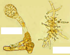 <p>Identify the male and female gametophyte of Laminaria brown algae (phylum Phaeophyta).</p>