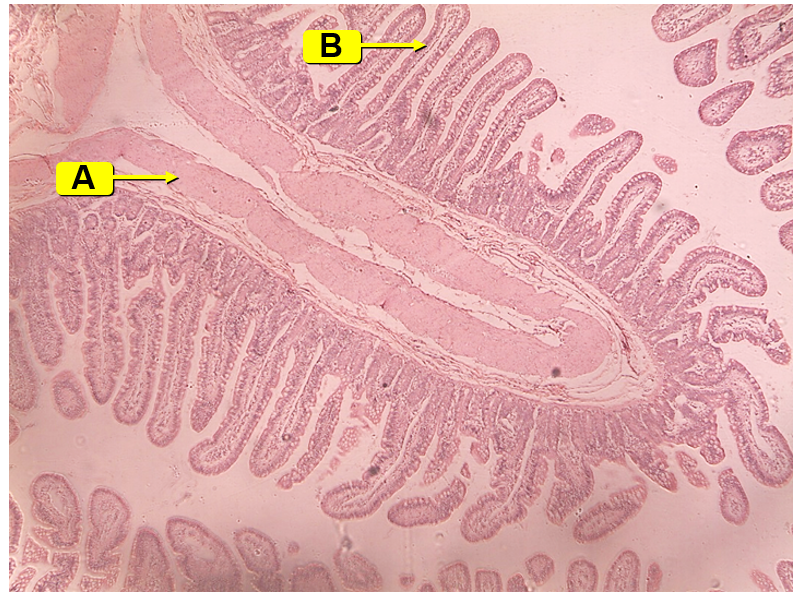 <p>intestinal lining</p><ul><li><p>A: circular folds</p><ul><li><p>increase surface area</p></li><li><p>line the small intestine</p></li></ul></li><li><p>B: villi</p><ul><li><p>lining the circular folds of the small intestine</p></li><li><p>increase surface area</p></li><li><p>lined with simple squamous epithelium which contain microvilli</p></li></ul></li></ul><p>*<span>The circular fold is the whole structure extending off of the intestinal wall and it is lined with villi</span></p>